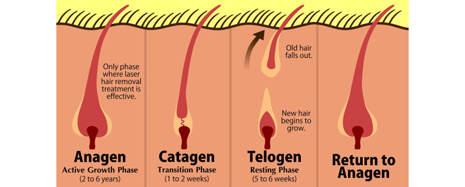 rosacea2